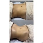 Foto antes e depois drenagem